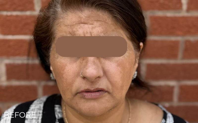 image comparison before