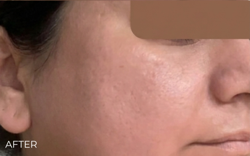 image comparison after