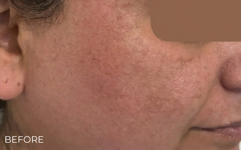 image comparison before